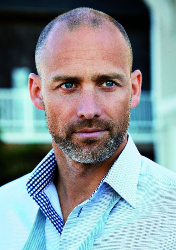 Hairstyles for balding men 18 ideas: Embrace your style with confidence